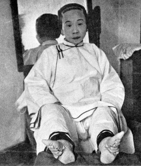 (miniature) Les pieds bandés avaient une forte connotation sexuelle en Chine