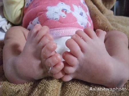 (miniature) bébé 8 orteils