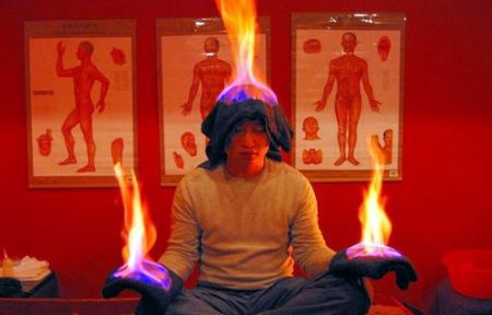(miniature) Huo Liao, thérapie par le feu