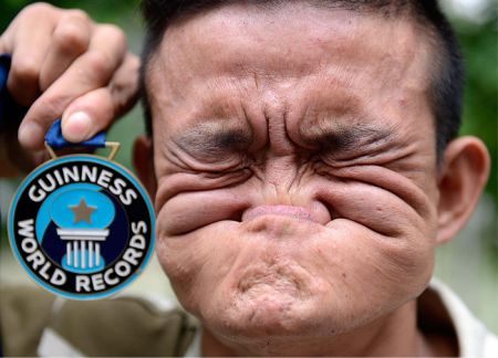 (miniature) Le record du monde du visage le plus tordu détenu depuis 10 ans par un chinois