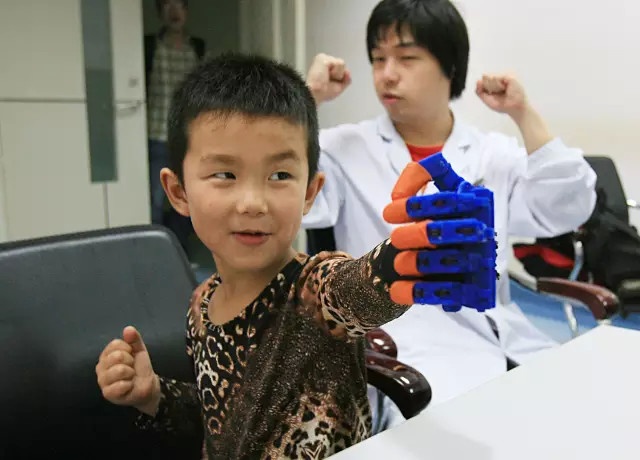 Chine : La premire main artificielle imprime en 3D, offerte  un enfant